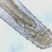 Anterior (head) end of adult Spinitectus nematode.