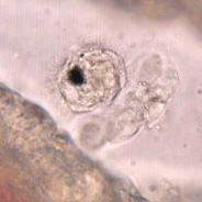 Sanguinicola miracidium near gill filament.