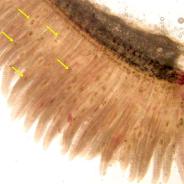 Trematode metacercariae (arrowed) in gills.