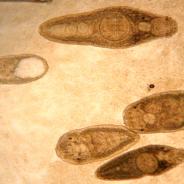 Several species of adult trematodes from intestine.