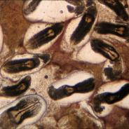 High magnification view of liver squash showing heavy infestation of white grub.