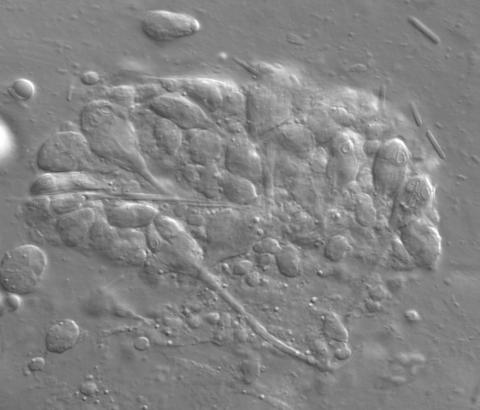 Plasmodium of developing Myxobilatus 11M21 myxospores.