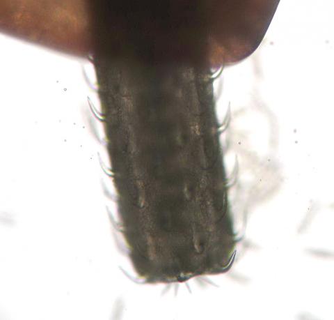 Thorny proboscis of acanthocephalan.