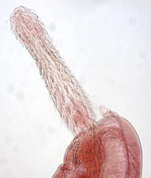 Proboscis of Echinorhynchus gadi.