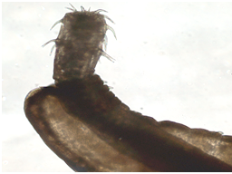 Anterior end of Rhadinorhynchus acanthocephalan.