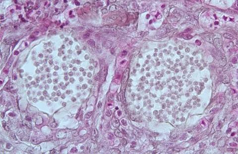 Dermocystidium in cysts