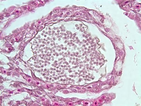 Dermocystidium in cysts