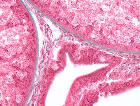 Boundary between host and glugea xenoma