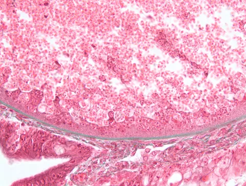 Boundary between host and glugea xenoma