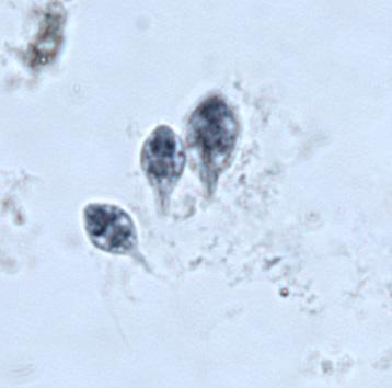 Hexamita in stained skin smear