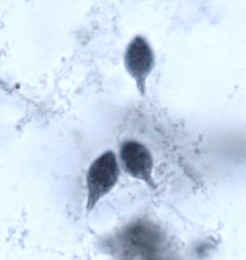 Hexamita in stained skin smear