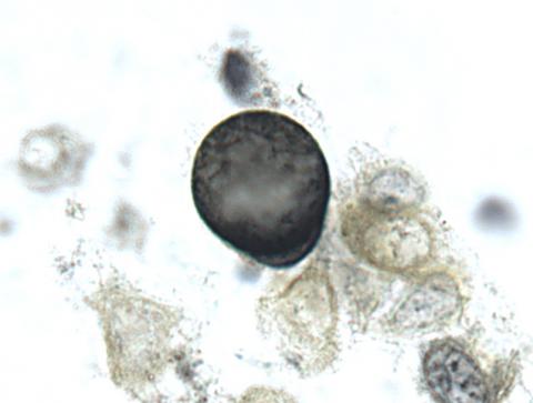 Ichthyobodo in fish skin smear.