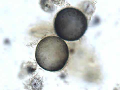 Ichthyobodo in fish skin smear.