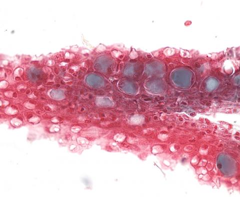 Ichthyobodo in Chinook gill section.