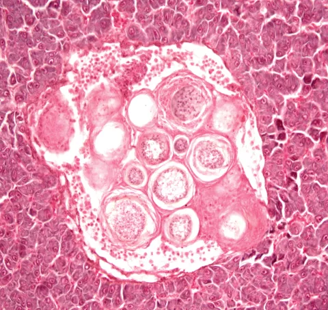 Histological image showing muscle tissue infected with ichthyophonus.