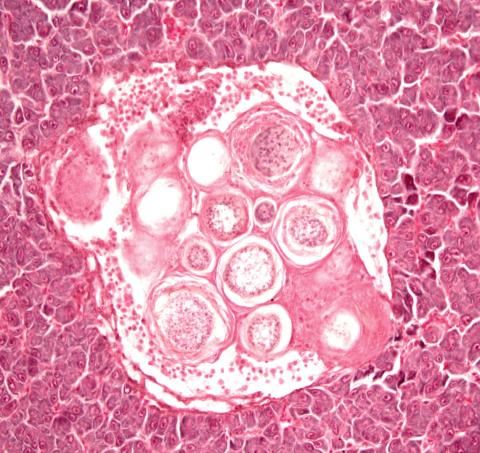 Histological image showing muscle tissue infected with ichthyophonus. 