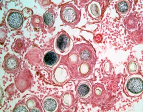 Histological image showing muscle tissue infected with ichthyophonus. 