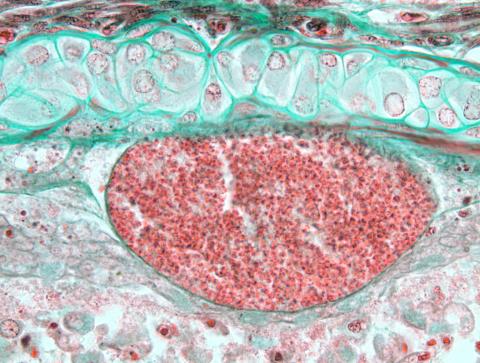 Loma cyst in gill filament.