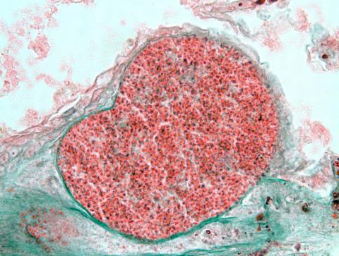 Loma cyst in gill filament.