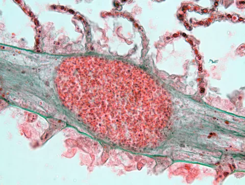Loma cyst in gill filament.