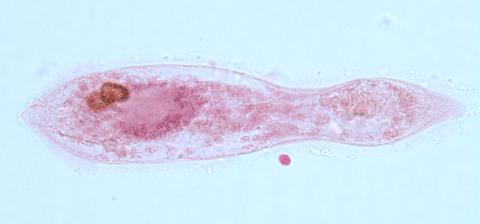 Sanguinicola blood fluke miracidium