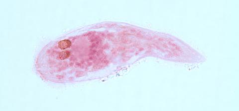 Sanguinicola blood fluke miracidium