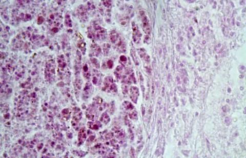 Tissue section showing mycobacterium lesion in sculpin.