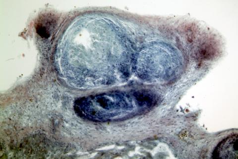 Tissue section showing mycobacterium lesion in sculpin.