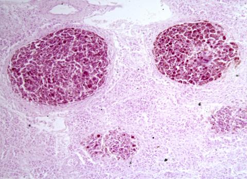 Tissue section showing mycobacterium lesion in sculpin.