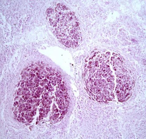 Tissue section showing mycobacterium lesion in sculpin.