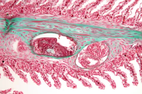 Tissue section showing a trematode metacercaria in steelhead gill filament.