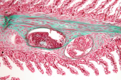 Tissue section showing a trematode metacercaria in steelhead gill filament.