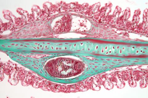 Tissue section showing a trematode metacercaria in steelhead gill filament.