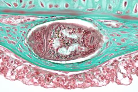 Tissue section showing a trematode metacercaria in steelhead gill filament.