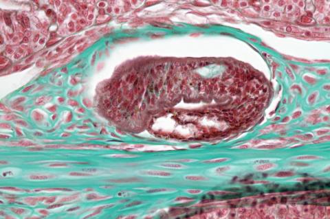 Tissue section showing a trematode metacercaria in steelhead gill filament.