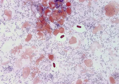 Renibacterium visible in histological section.