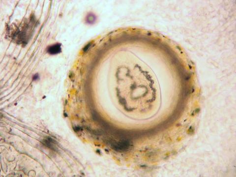 Trematode metacercaria from skin of trout.