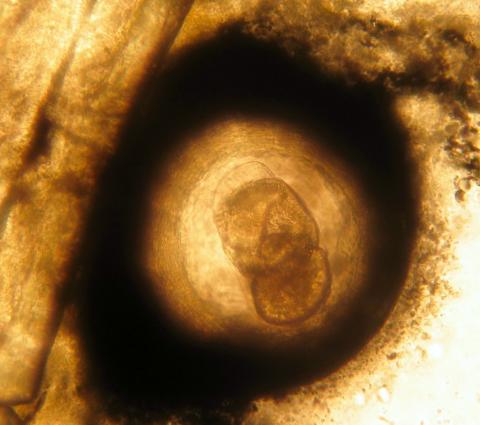 Trematode metacercaria (black spot) in fin of sucker.