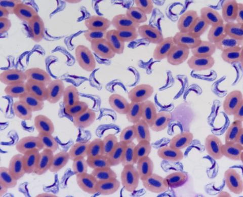 Stained blood smear showing hemoflagellates.