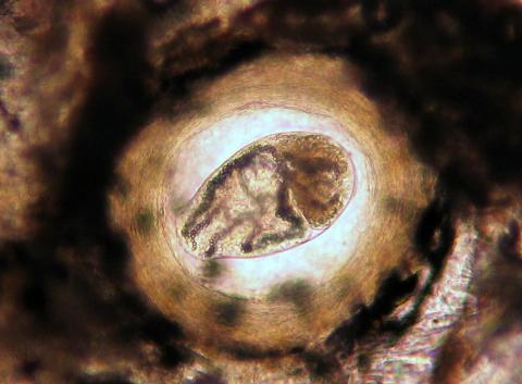 Trematode metacercaria from skin of coho salmon.