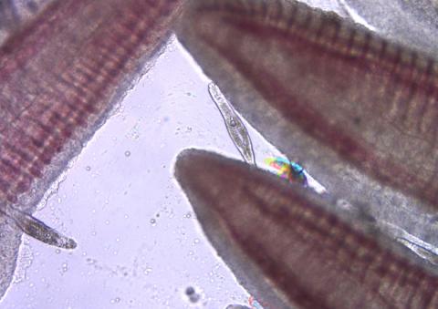 Dactylogyrus on gill filaments.