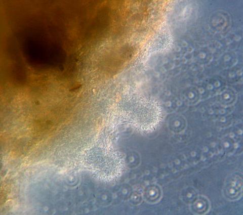 Characteristic "columns" of Flavobacterium.