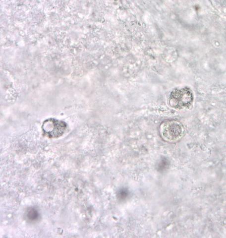 Amoeba in gill.