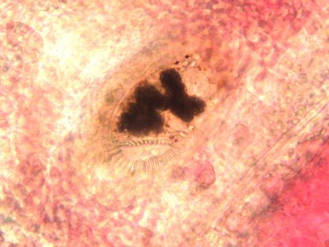 Trematode (Family Heterophyidae) developing within gill filaments.