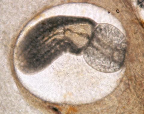 Trematode metacercaria.