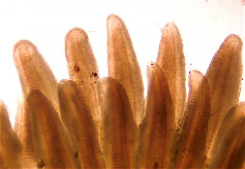 Gills showing fuzzy margins associated with BKD