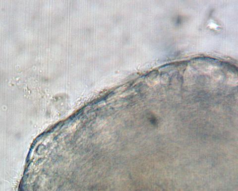 Filamentous flavobacteria on surface of gill.