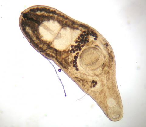 Adult trematode from intestine.