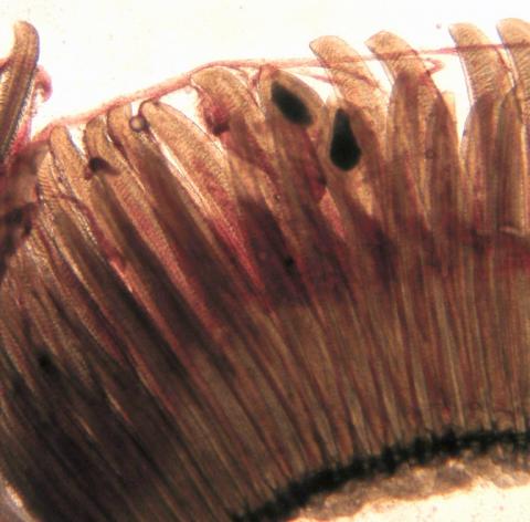 Cysts of Myxobolus spores in gill filaments.