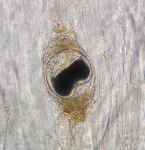 Metacercaria of Nanophyetus in muscle.